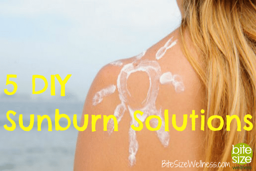 Treating Sunburns