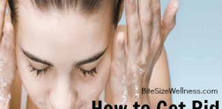 How to Get Rid of Acne Naturally