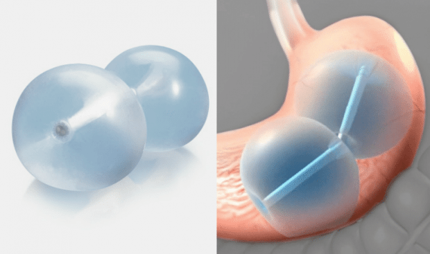 obesity, FDA, ReShape Dual Balloon